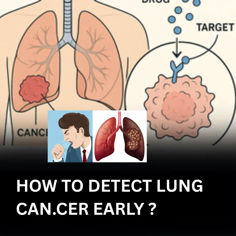 HOW TO DETECT LUNG CAN.CER EARLY ?