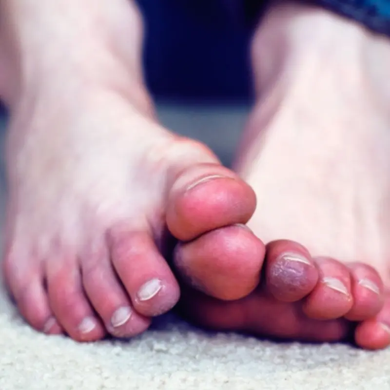 Your Feet May Be a “Blood Sugar Monitor”