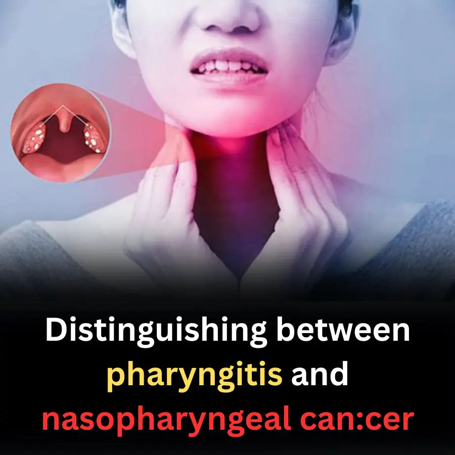 Distinguishing between pharyngitis and nasopharyngeal can:cer
