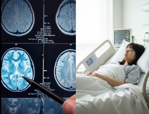 5 Alarming Stroke Warning Signs to Watch for in Young People