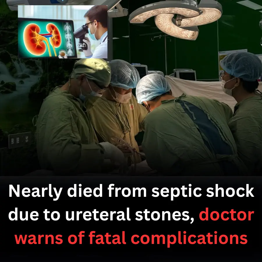 Nearly died from septic shock due to ureteral stones, doctor warns of fatal complications