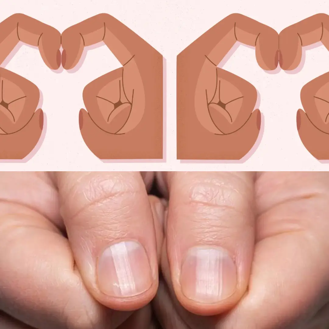 Don’t Ignore These 4 Finger Changes — They Might Point to Lung Can.cer