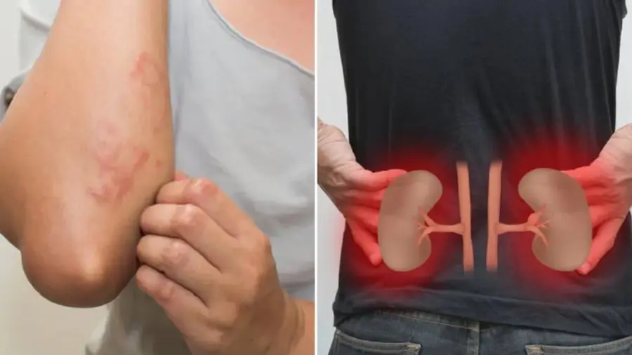 8 signs you may be experiencing kid.ney fai.lure