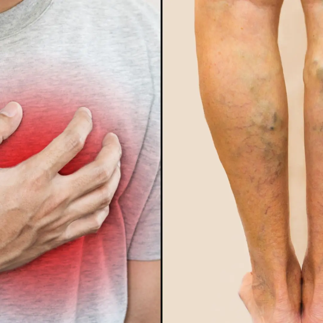 10 signs of coronary heart disease you must never ignore
