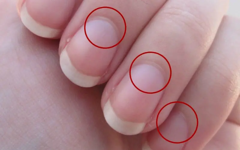 What does the half moon at the base of the nails mean?