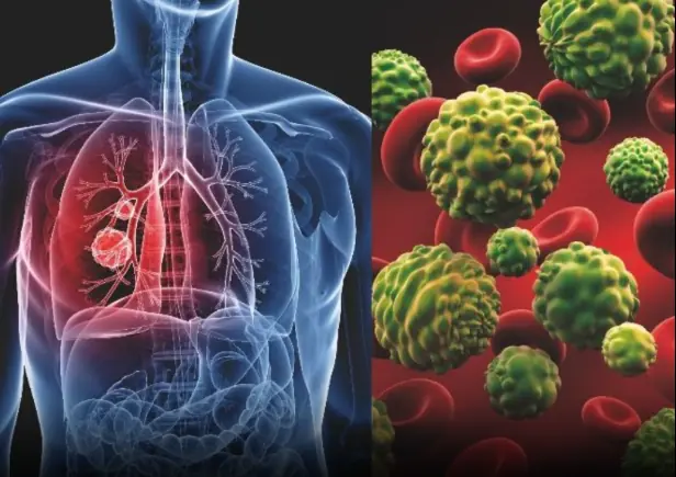 8 of the Best Anti-Cancer Foods. It’s Time to Start Adding them to Your Diet