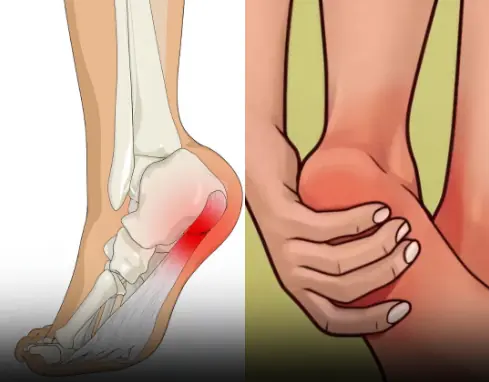 7 Powerful Exercises to Relieve Heel Pain and Treat Plantar Fasciitis Naturally