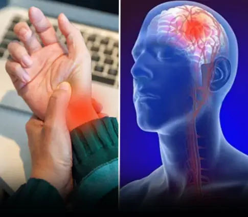 Recognizing Mini-Stroke Symptoms: A Crucial Step in Stroke Prevention