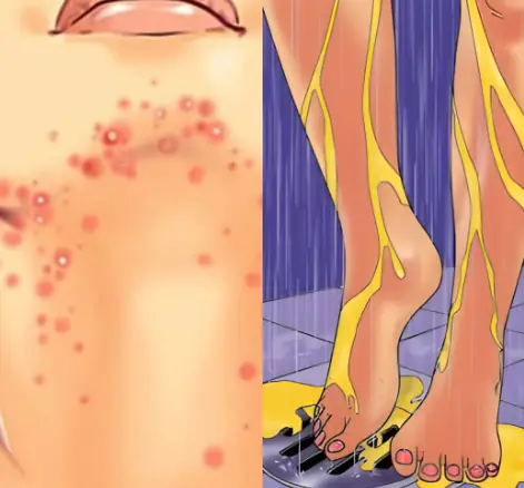 9 Warning Signs of Diabetes You Shouldn’t Ignore