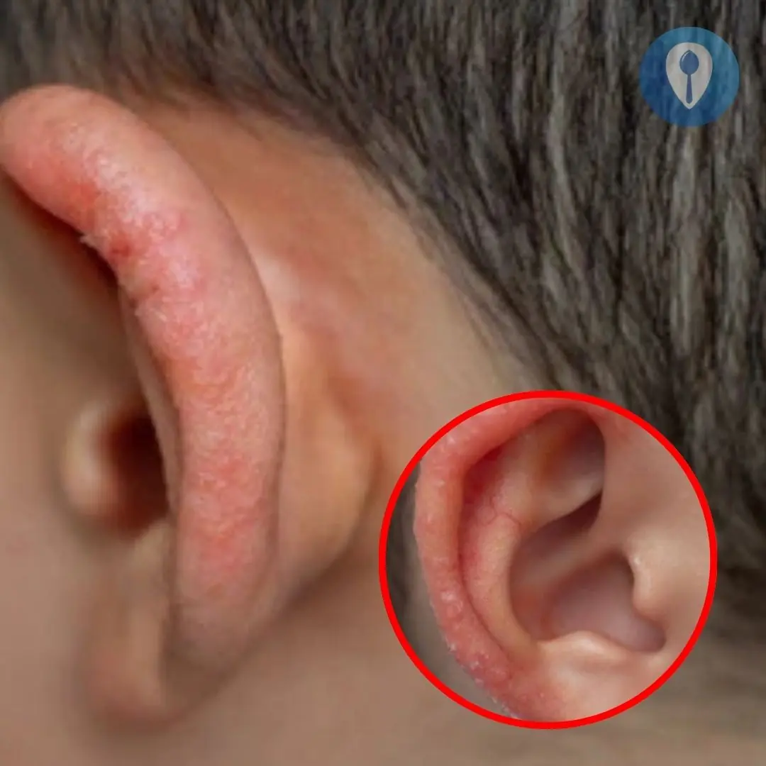 I noticed a strange patch of skin on my son’s ear this morning. His doctor appointment is still a week away — what should I do in the meantime?