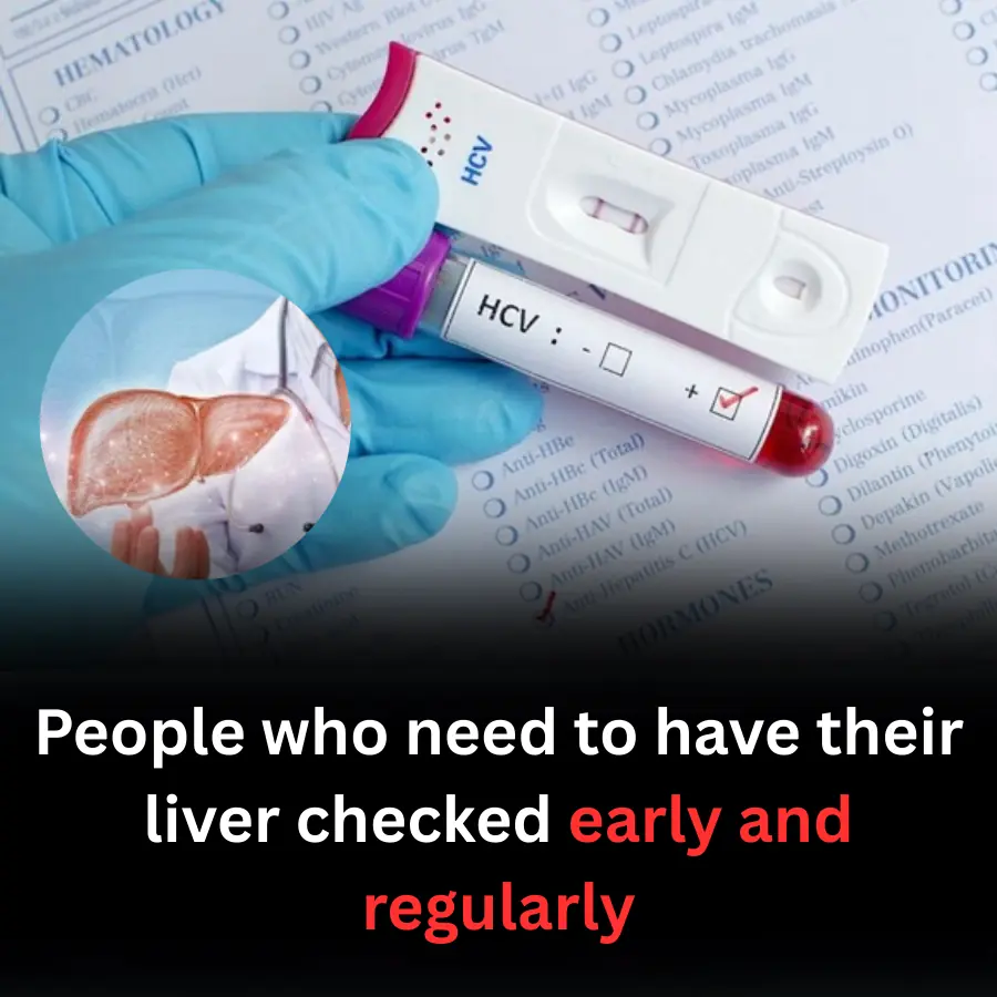 People who need to have their liver checked early and regularly