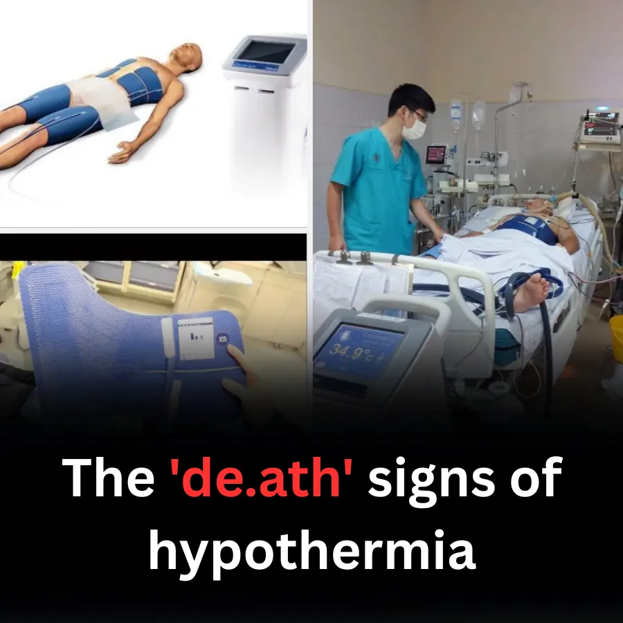 The 'de.ath' signs of hypothermia