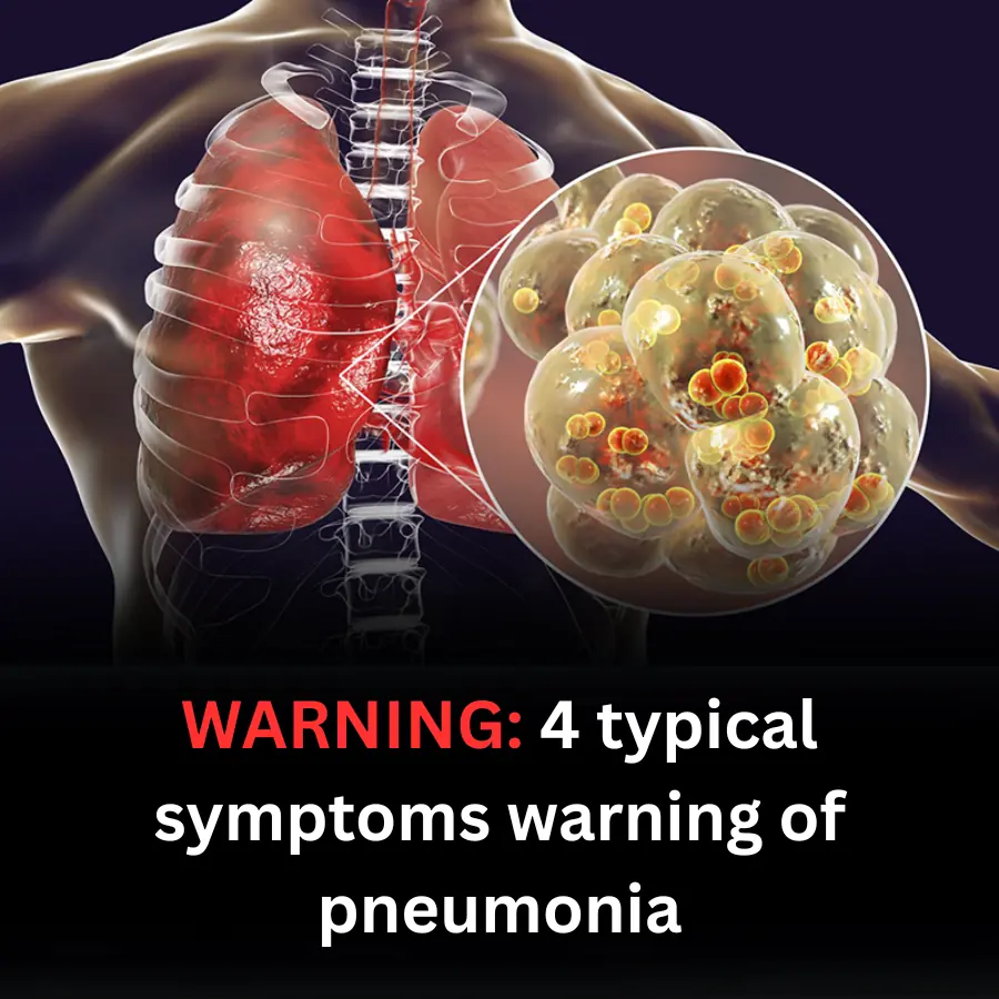 4 typical symptoms warning of pneumonia