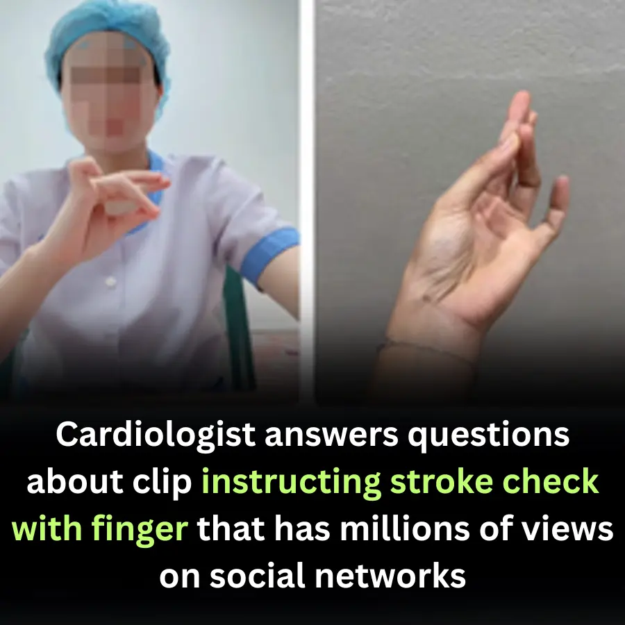 Cardiologist answers questions about clip instructing stroke check with finger that has millions of views on social networks