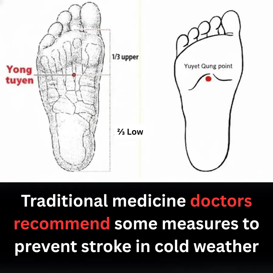 Traditional medicine doctors recommend some measures to prevent stroke in cold weather