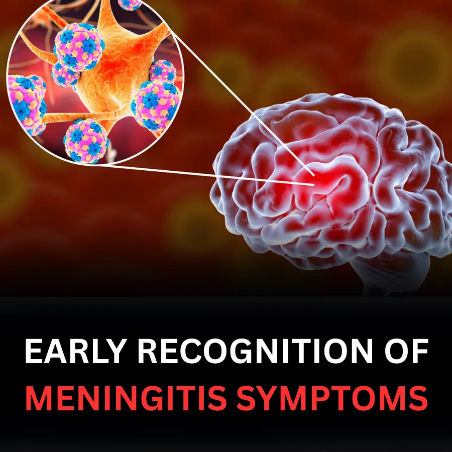 EARLY RECOGNITION OF MENINGITIS SYMPTOMS