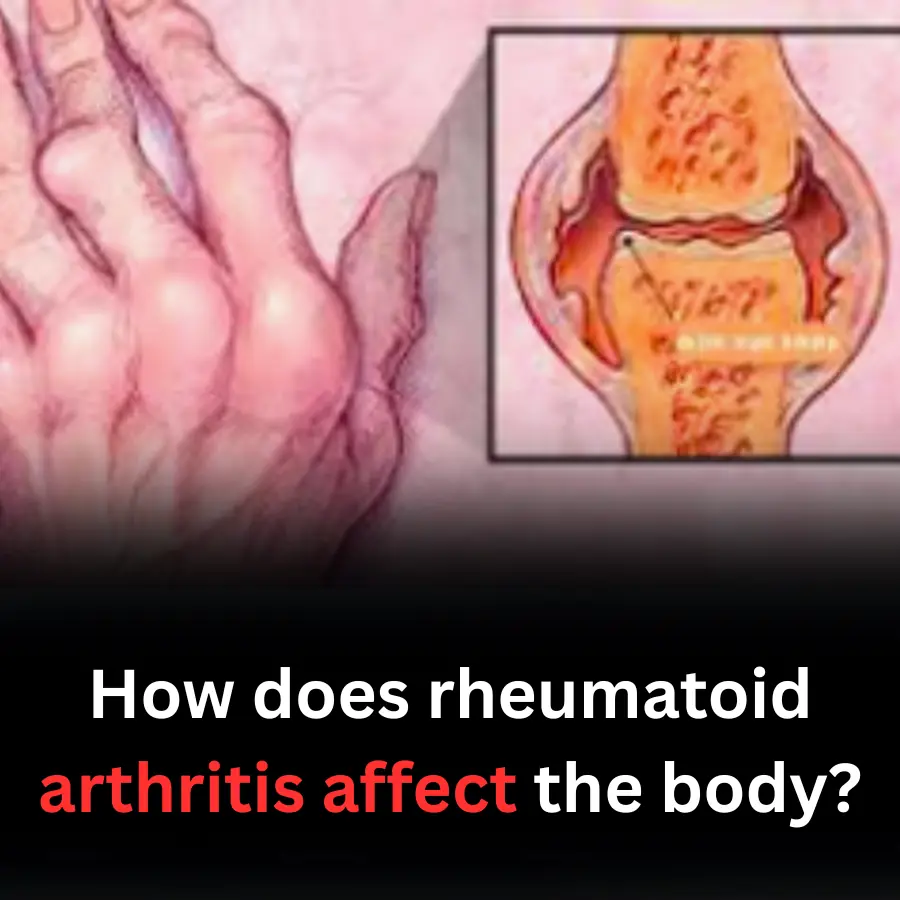 How does rheumatoid arthritis affect the body?