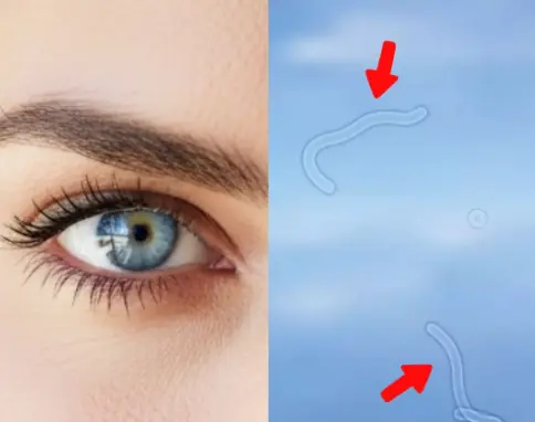What Are Eye Floaters? Here What To Do If you Start Seeing Them, According to an Eye Doctor