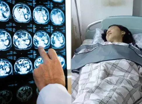 5 Alarming Stroke Warning Signs to Watch for in Young People