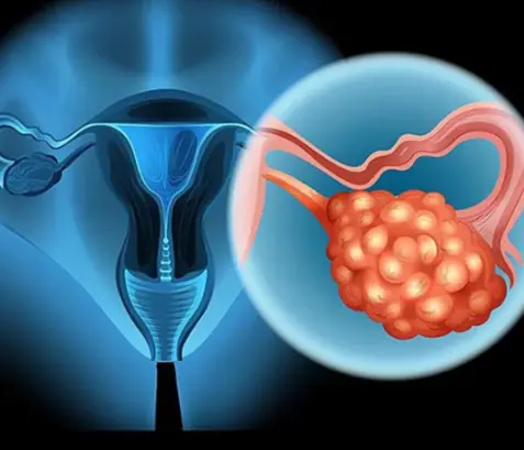 8 Early Warning Signs Of Ovarian Can:cer You Shouldn’t Ignore