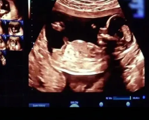 Scientists May Have Actually Found One Of The Causes Of Autism