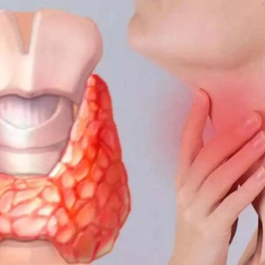 6 Types of Foods That Negatively Affect Your Thyroid — What to Limit or Avoid