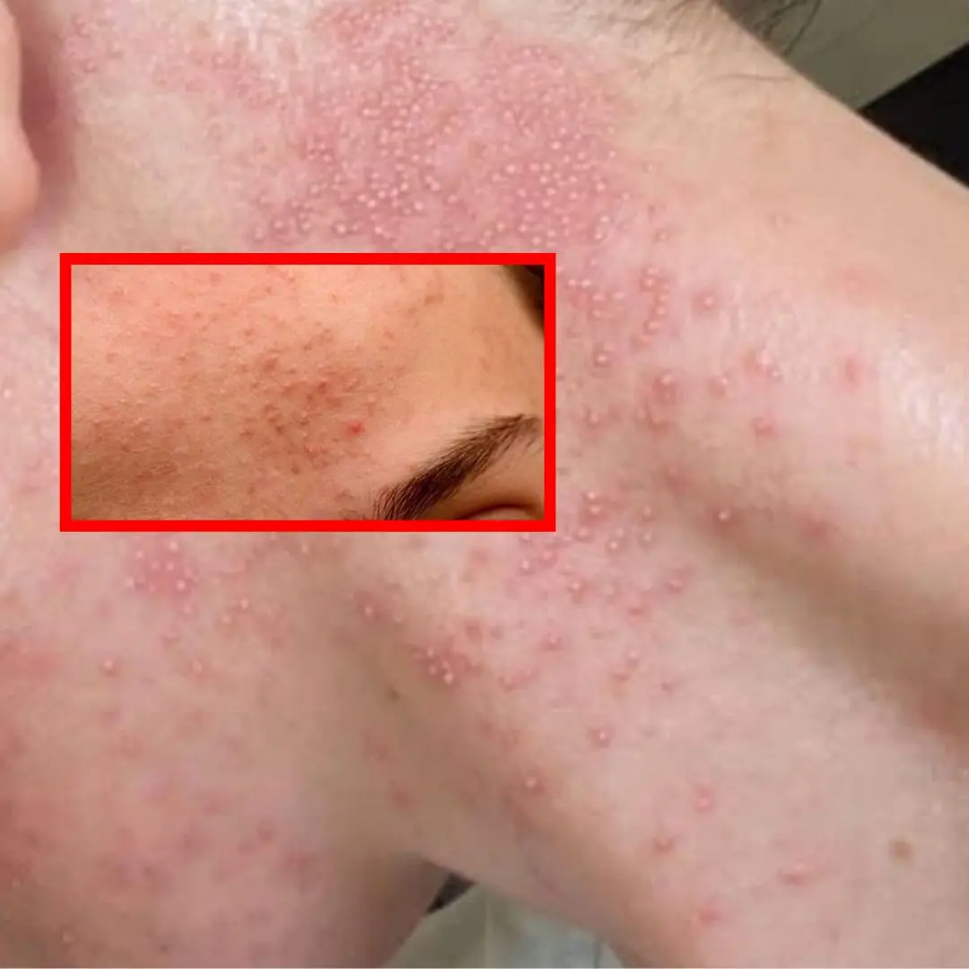 These are the consequences of eating....