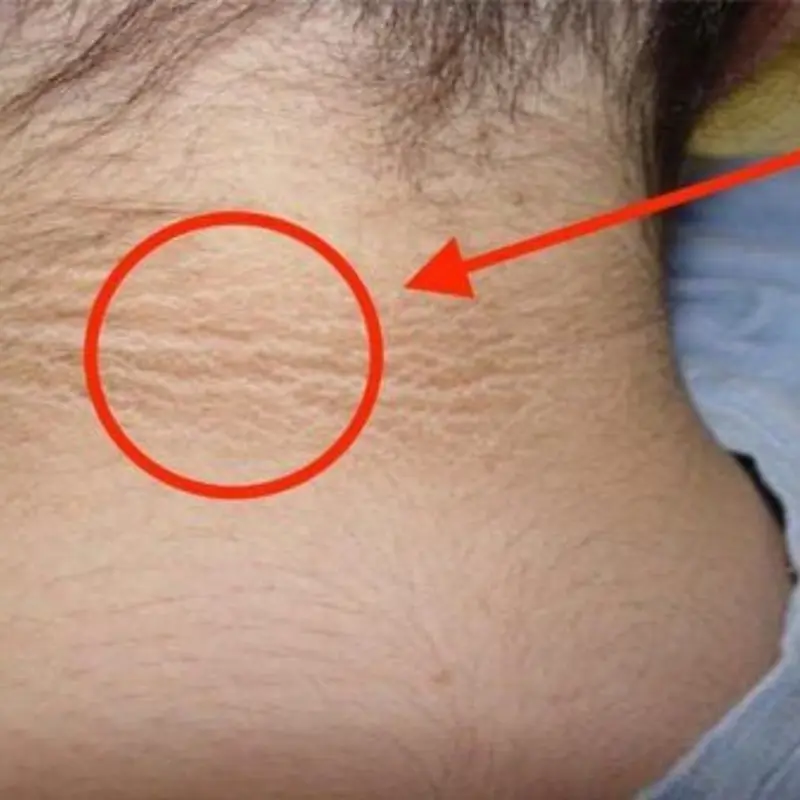 Don’t Ignore These Silent Signs of Oral Cancer