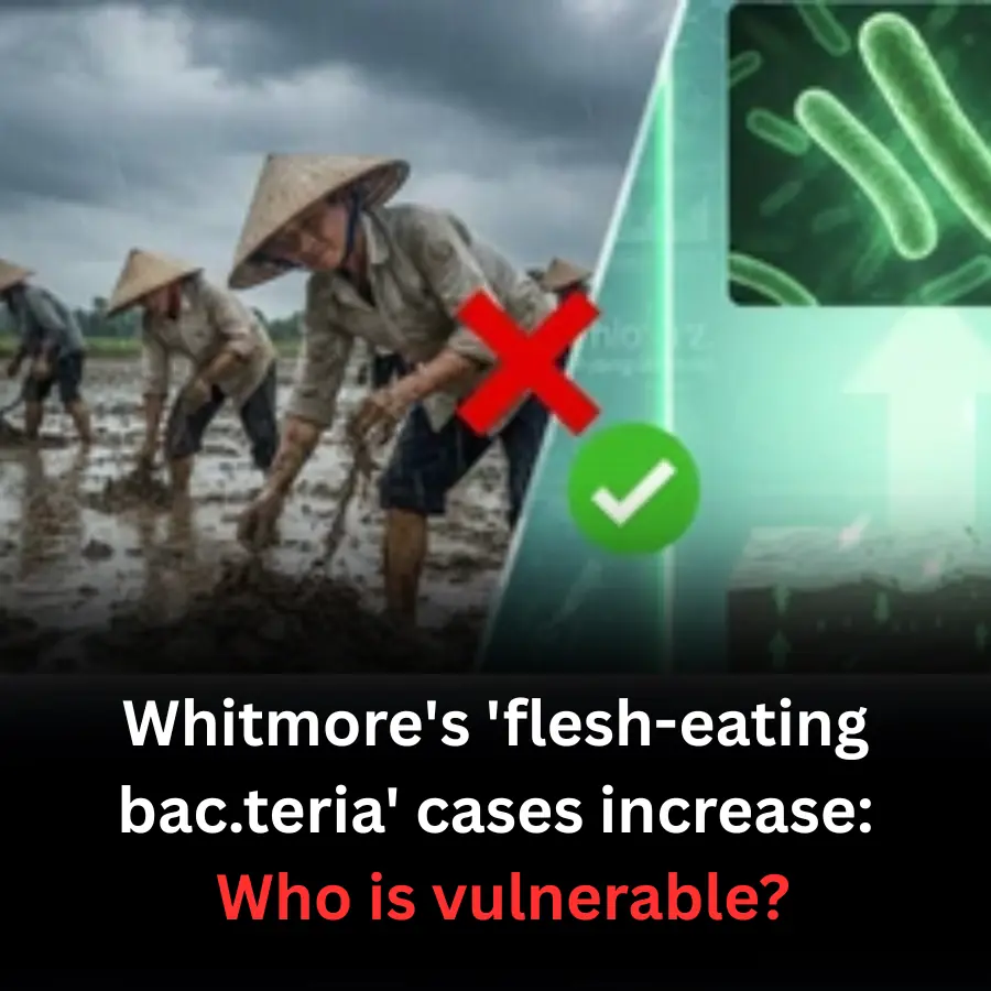 Whitmore's 'flesh-eating bac.teria' cases increase: Who is vulnerable?
