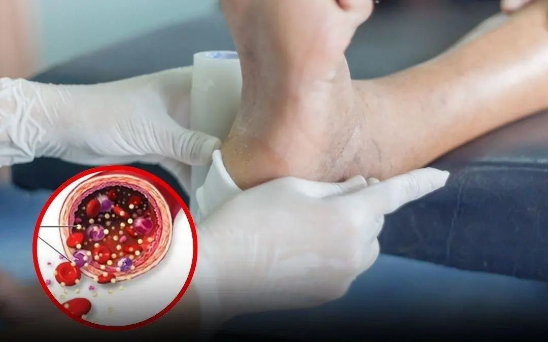 Your feet can reveal important warning signs about circulation and nerve health