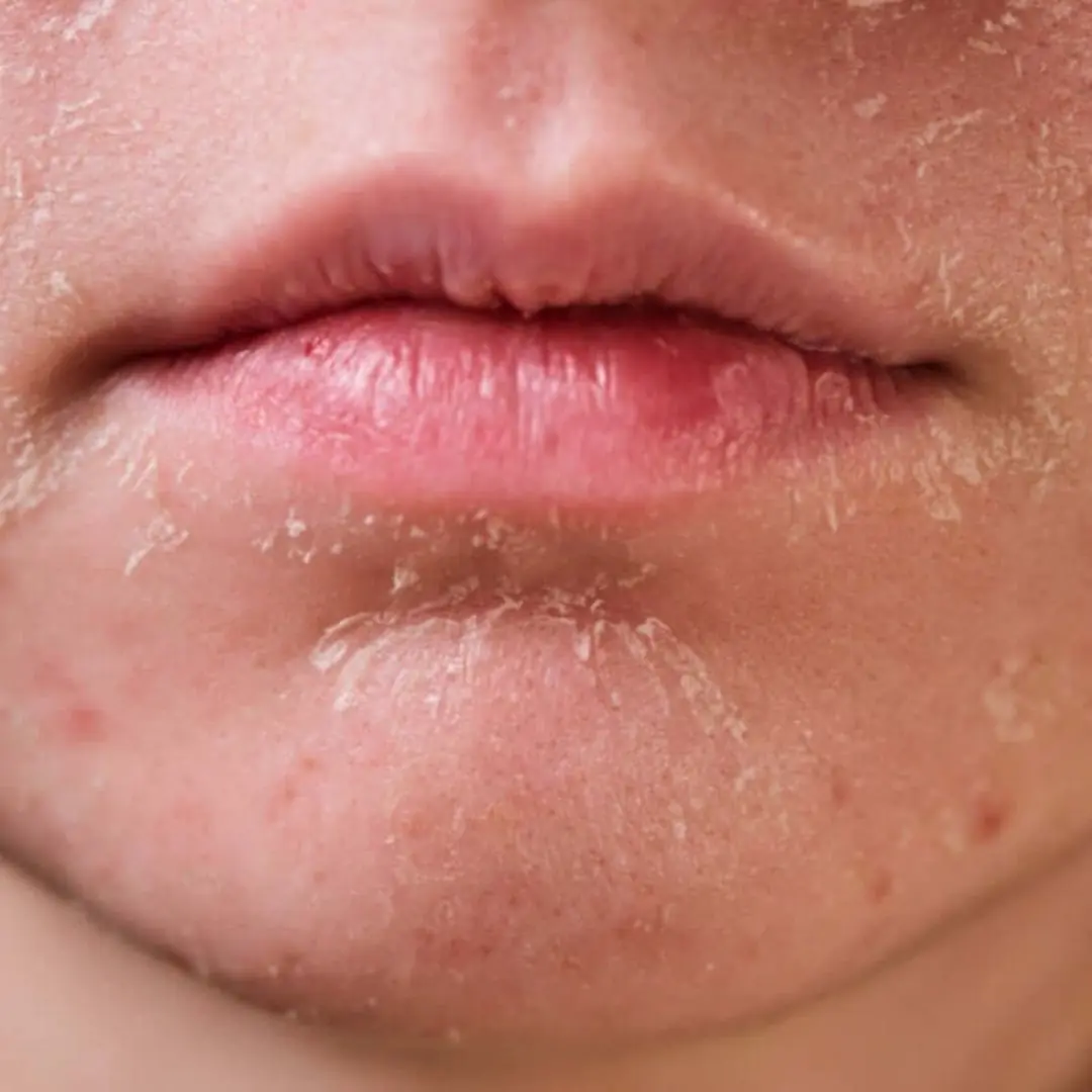 Your skin reveals kidney health — and people with strong kidneys never have these 3 signs