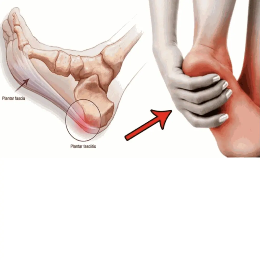 The Hidden Disease Behind Frequent Leg Numbness — And the Real Cause You Shouldn’t Ignore