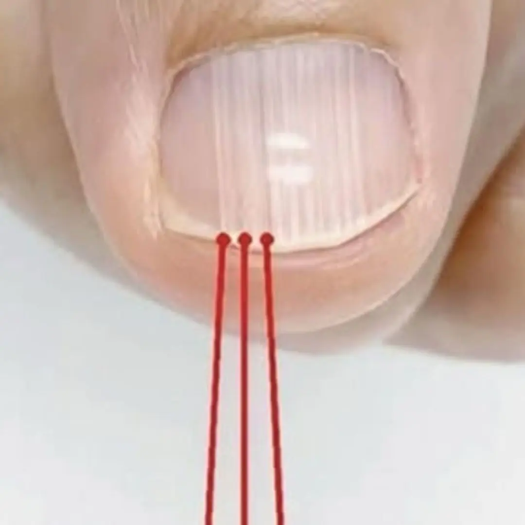 If you have these lines on your nails after 40, it is a clear sign that...