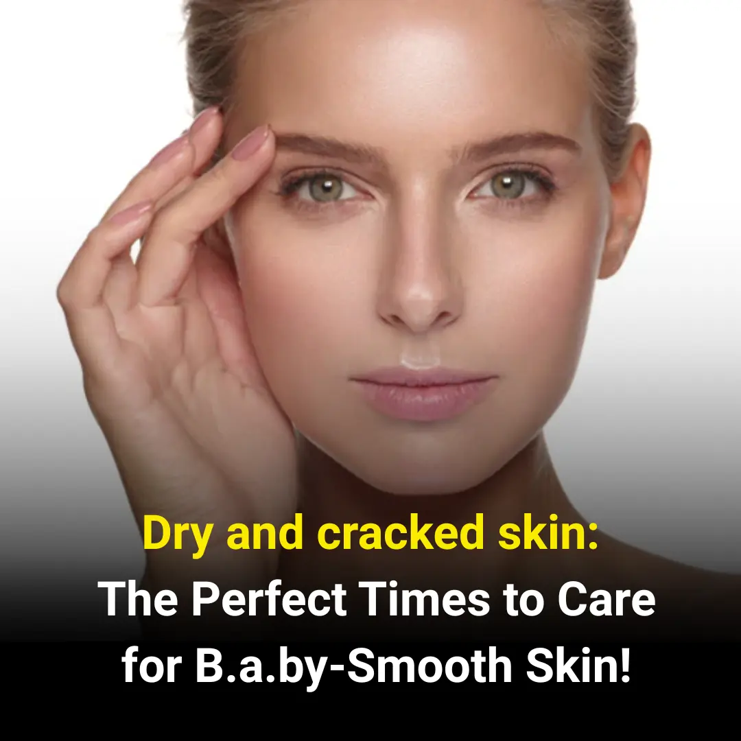Dry and cracked skin: The Perfect Times to Care for Baby-Smooth Skin!