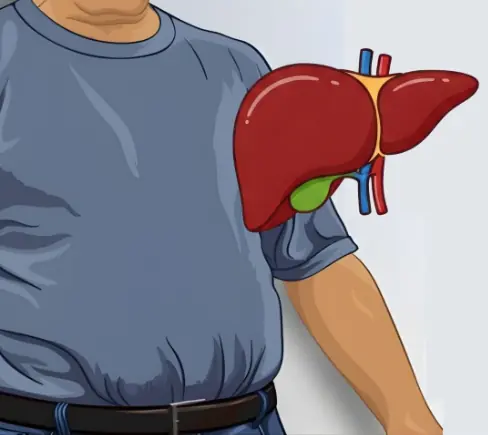 How to destroy your liver: 10 worst habits for fatty liver (hepatic steatosis)