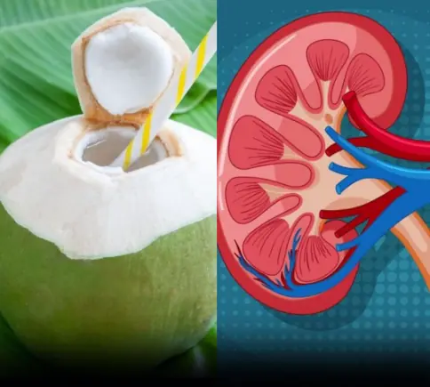 What really happens to your kidneys when you drink coconut water