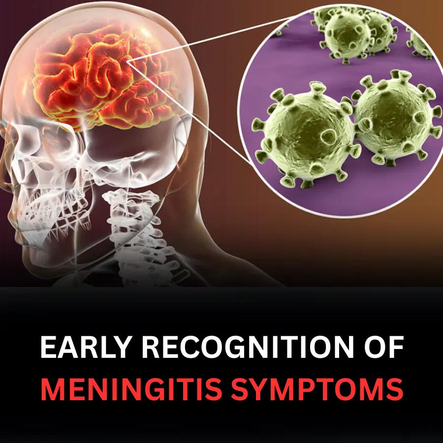 EARLY RECOGNITION OF MENINGITIS SYMPTOMS