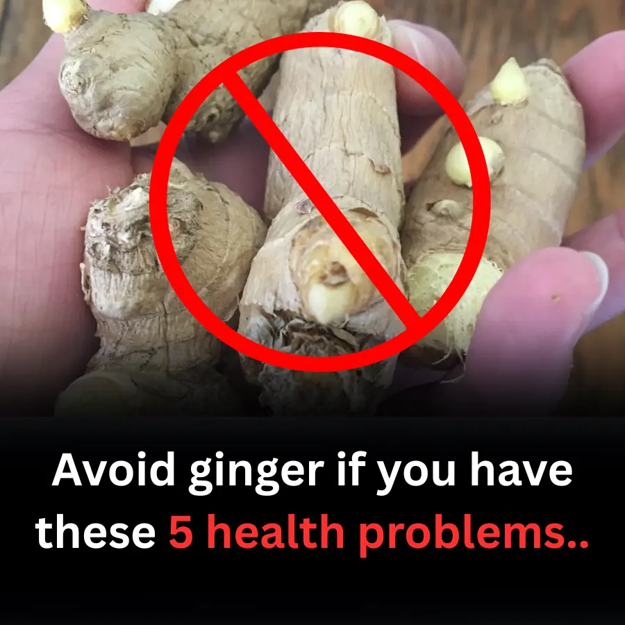 Avoid ginger if you have these 5 health problems..