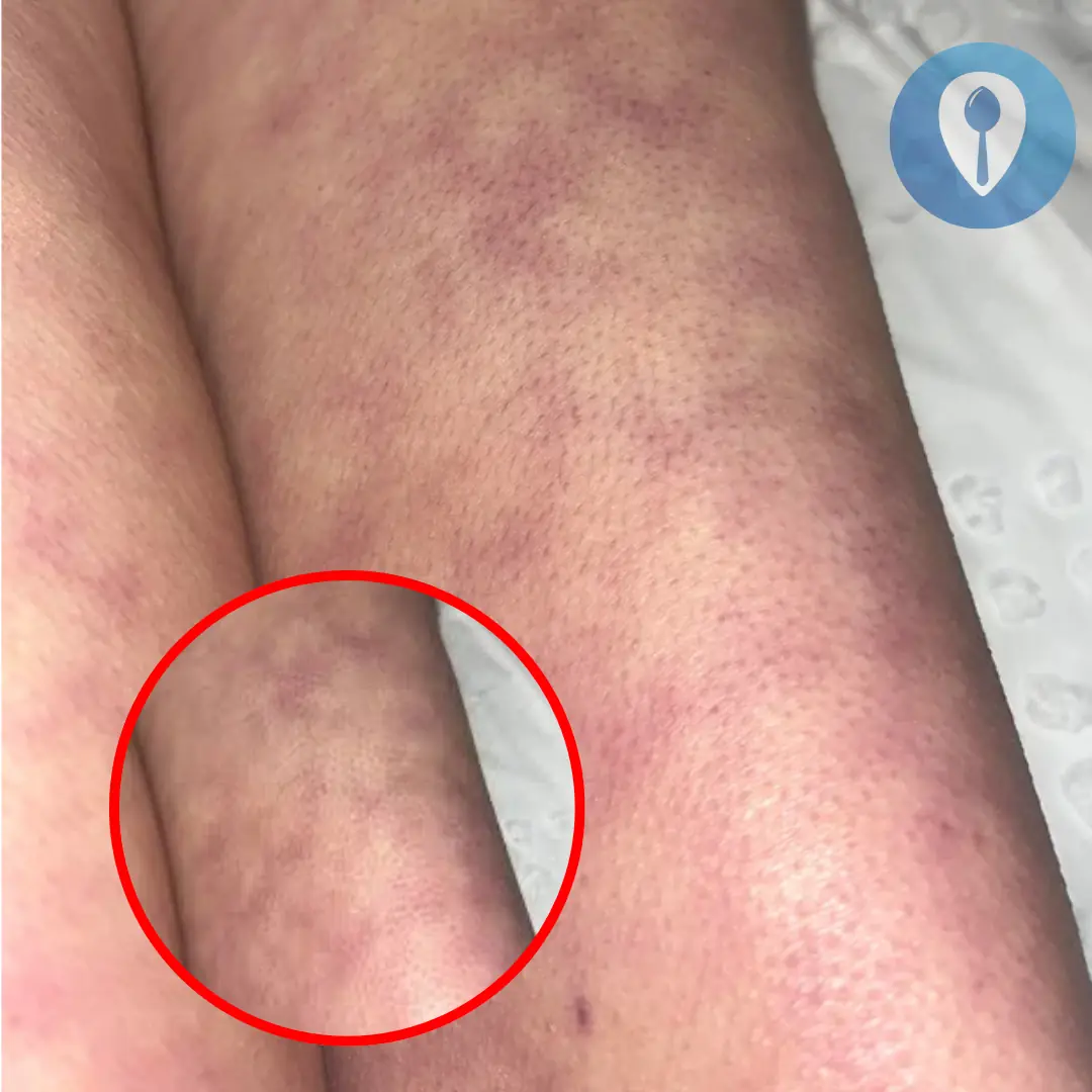 What those strange skin patterns might really mean