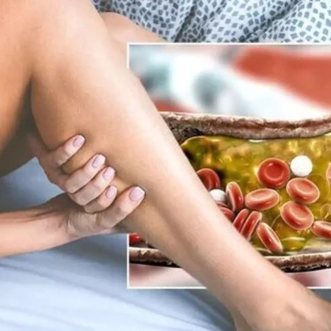 Warning Symptoms of Heart Blockage In Legs And Feet At Night