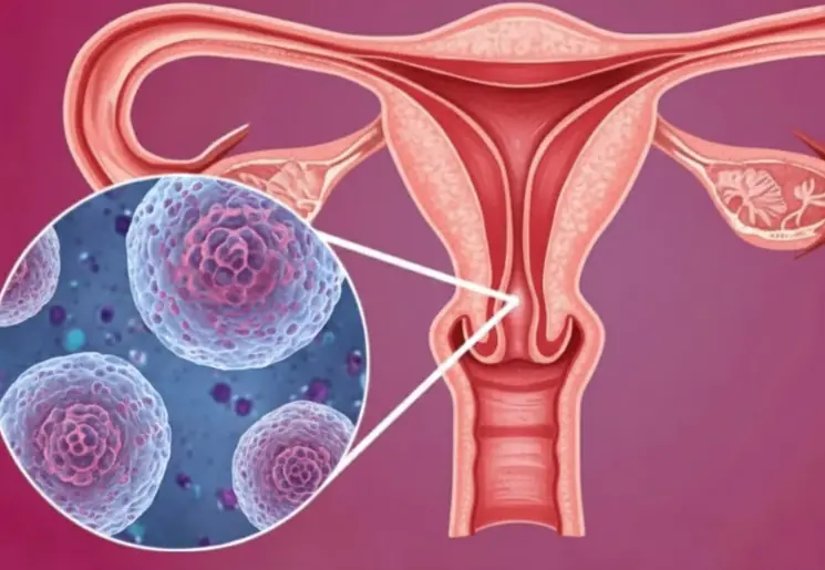 What every woman should know about cer.vical can.cer!
