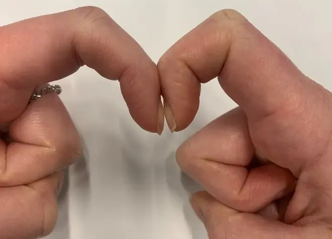 4 subtle changes in your fingers that may indicate lung can.cer - Don’t ignore these early clues