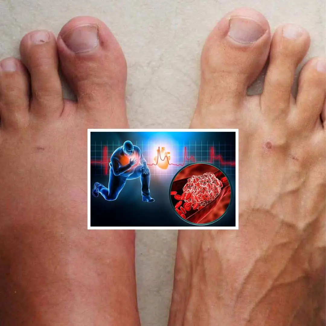 Warning signs of a heart attack?