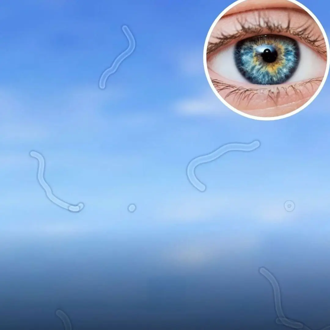 Eye doctor finally explains what it really means when you start seeing “floaters” — and what to do next