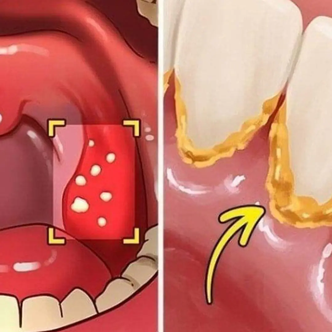 6 Effective Ways To Avoid Bad Breath Even After Sleeping