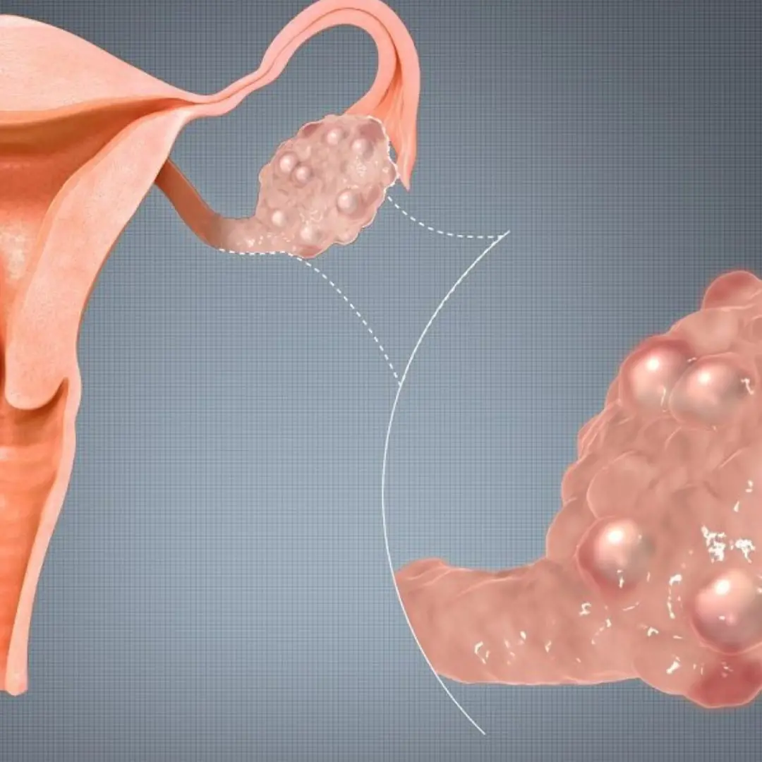 Women over 40 should seek medical attention immediately if these symptoms appear