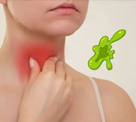 The Real Causes of Constant Phlegm and Mucus in Throat — And How to Get Rid of It