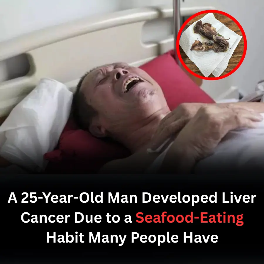 A 25-Year-Old Man Developed Liver Can.cer Due to a Seafood-Eating Habit Many People Have