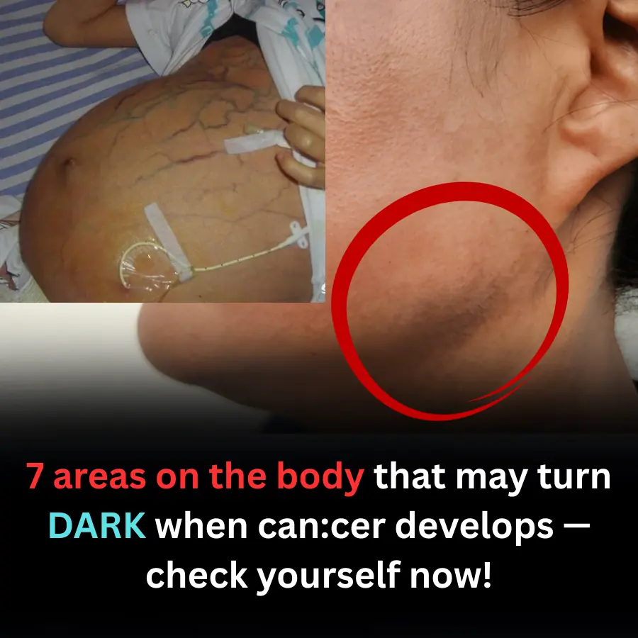 7 Body Areas That May Turn Dark When Can.cer Develops: Early Warning Signs You Should Never Ignore