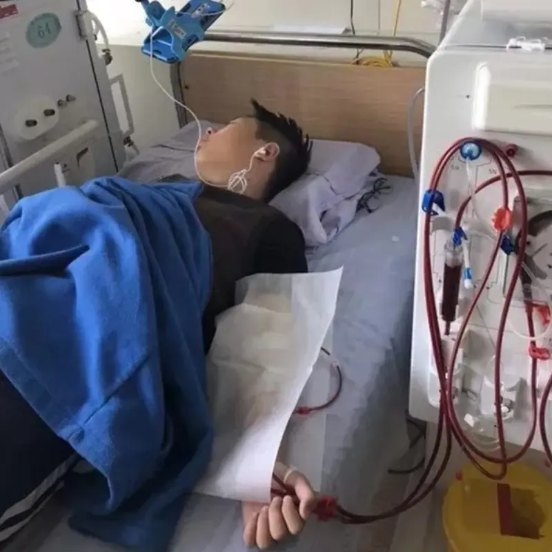 At Just 20, Forced to Undergo Dialysis for Life: Doctor Shocked